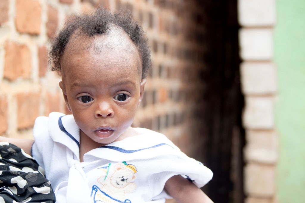 Little Miracle